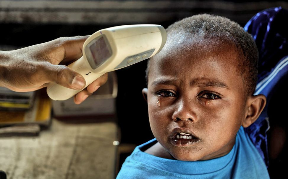 Malaria: Infizierte Kinder bekommen Wechselfieber oder Fieberschübe und andere anfangs unspezifische Symptome. 