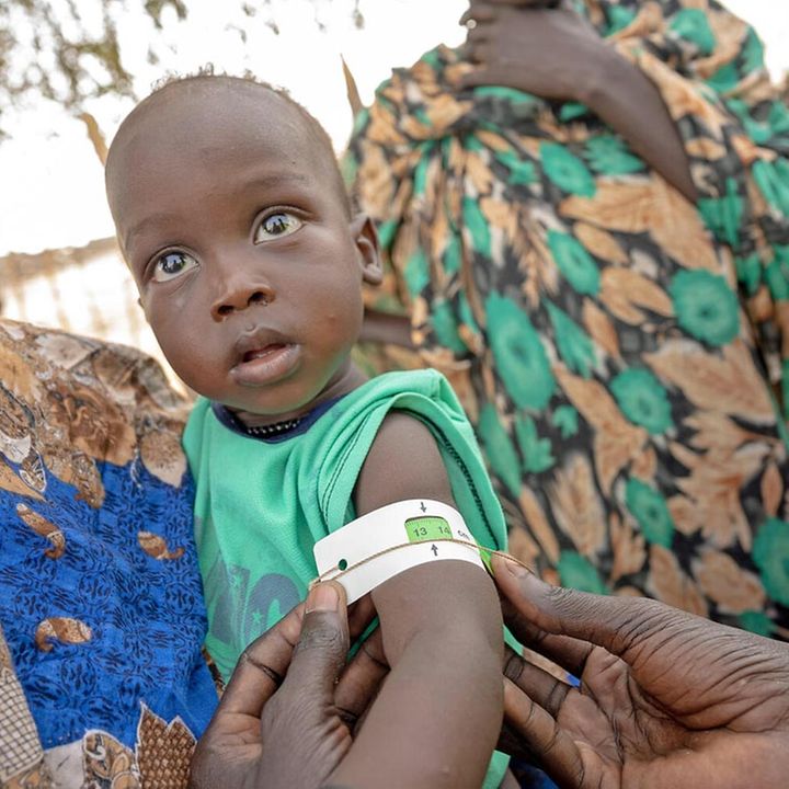 Südsudan Hungerkrise: Südsudanesische Kinder leiden unter Hunger und der Krise im Land