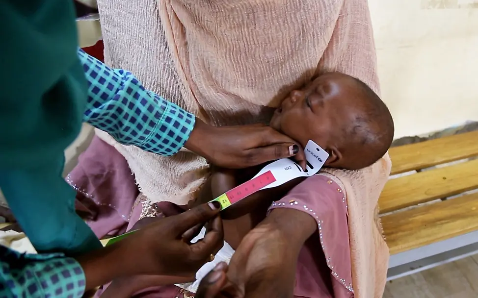 Hungersnot im Sudan besonders für Kinder gefährlich | © UNICEF/UNI593591 Einem Kleinkind wird der Armumfang gemessen, um den Grad der Mangelernährung zu prüfen