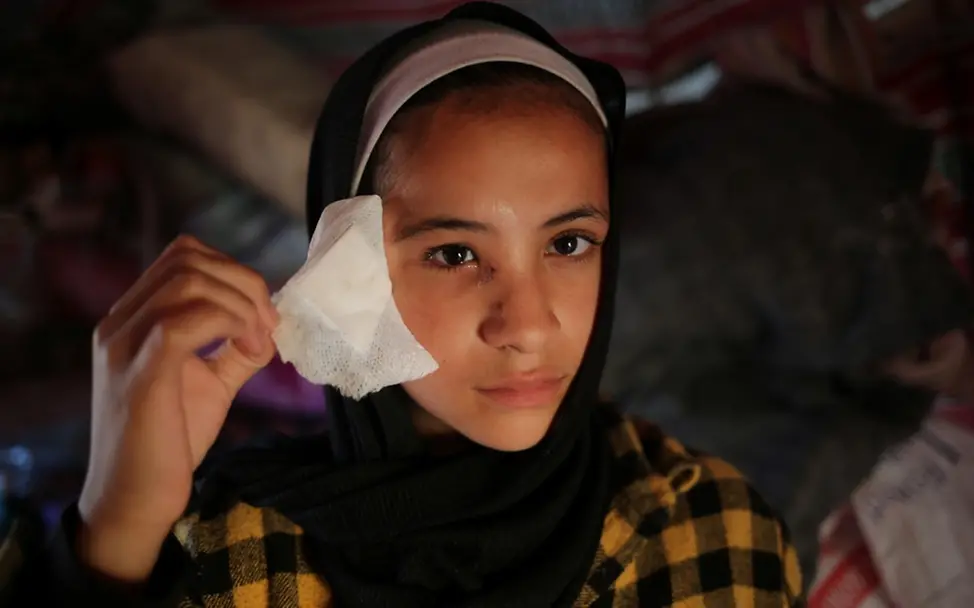 Spenden statt Schenken | © UNICEF/UNI544678/El Baba Die 15-jährige Abrar zeigt ihre Augenverletzung, die durch ein Schrapnell verursacht wurde.