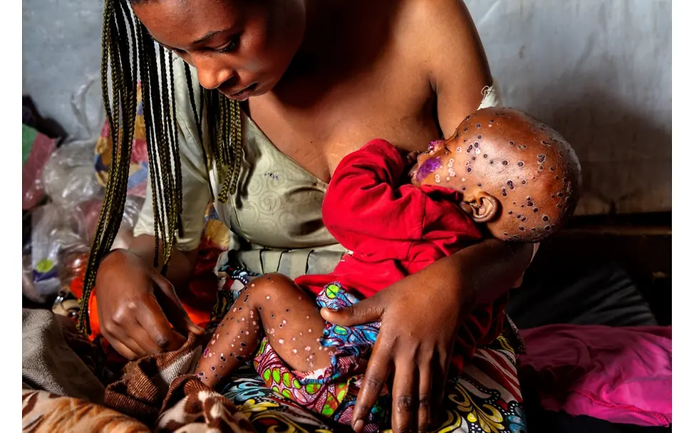 Democratic Republic of the Congo: A virus on the rise | © Pascal Maitre, France (The VII Foundation, for Paris Match) Democratic Republic of the Congo: A virus on the rise