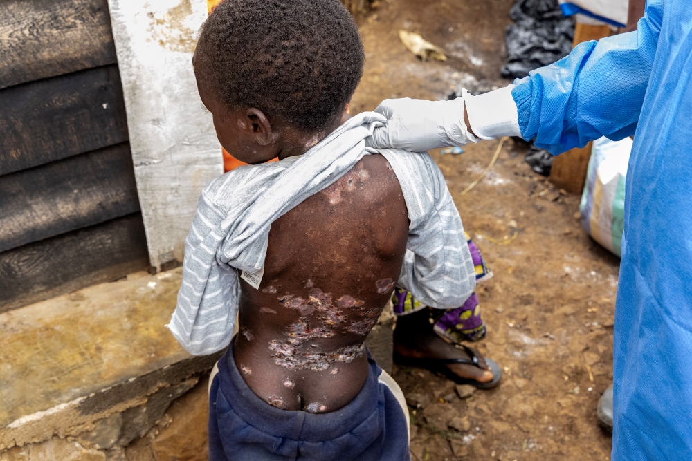 Democratic Republic of the Congo: A virus on the rise | © Pascal Maitre, France (The VII Foundation, for Paris Match) Democratic Republic of the Congo: A virus on the rise