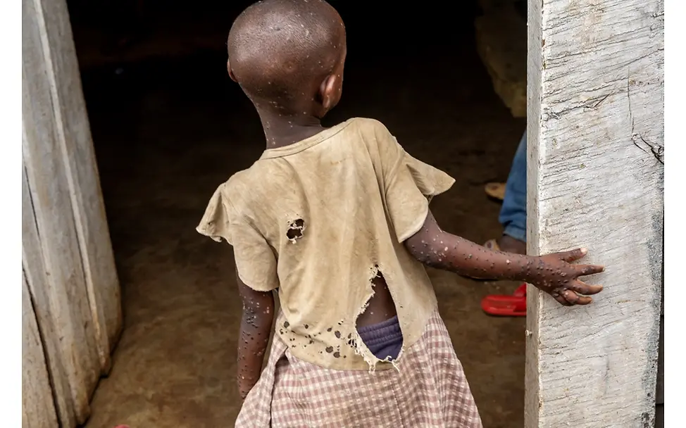 Democratic Republic of the Congo: A virus on the rise | © Pascal Maitre, France (The VII Foundation, for Paris Match) Democratic Republic of the Congo: A virus on the rise