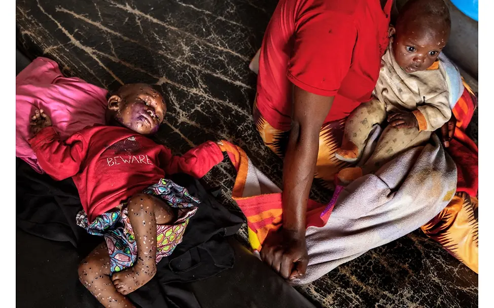 Democratic Republic of the Congo: A virus on the rise | © Pascal Maitre, France (The VII Foundation, for Paris Match) Democratic Republic of the Congo: A virus on the rise