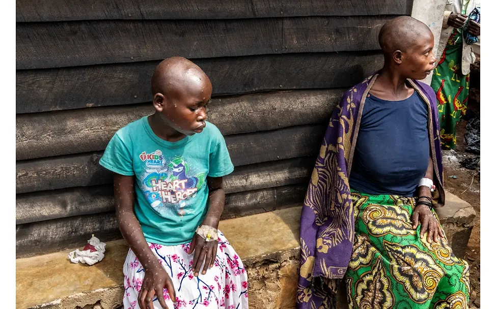 Democratic Republic of the Congo: A virus on the rise | © Pascal Maitre, France (The VII Foundation, for Paris Match) Democratic Republic of the Congo: A virus on the rise