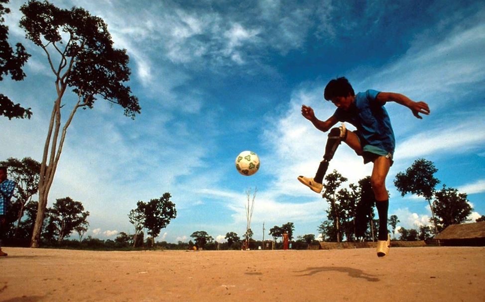 Ein beinamputierter Junge in Thailand spielt Fußball.  ©UNICEF/Pizer