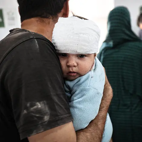 Ein verletzter Junge in Gaza | © UNICEF/UNI799061/El Baba Ein Junge mit Verband um den Kopf