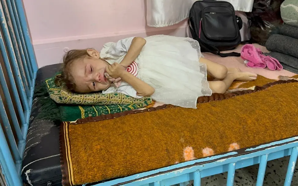 Mariam (2) liegt in einem Bett im Krankenhaus im Gazastreifen.| © UNICEF/Eleyan Kinder Gaza: Mariam (2) liegt in einem Bett im Krankenhaus im Gazastreifen.
