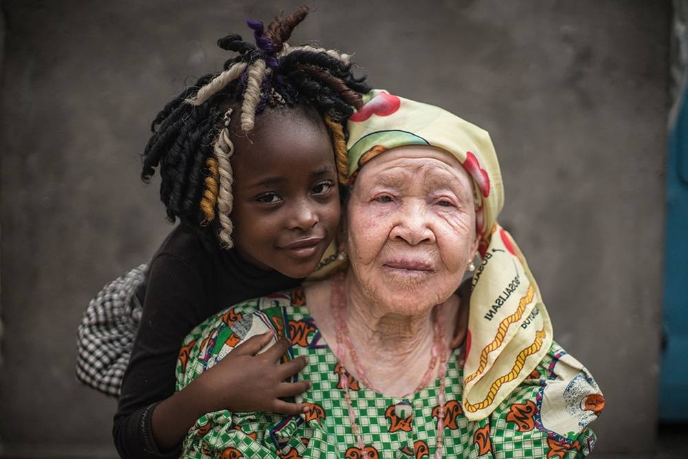 Congo: Albinism - White Ebony | © Patricia Willocq/Corbis Images