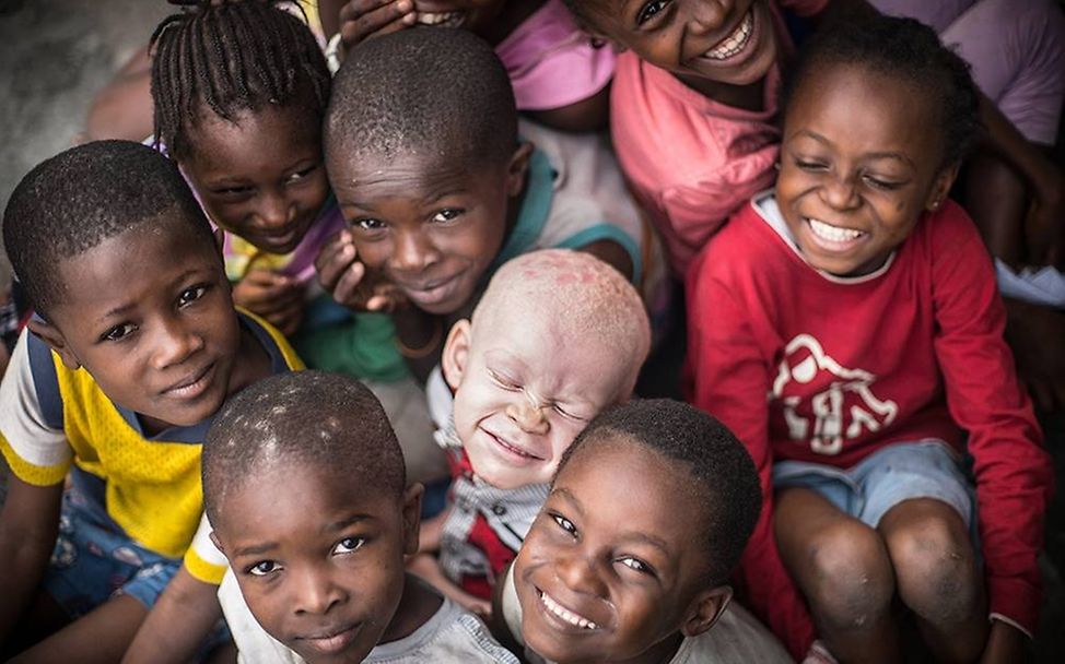 Congo: Albinism - White Ebony | © Patricia Willocq/Corbis Images