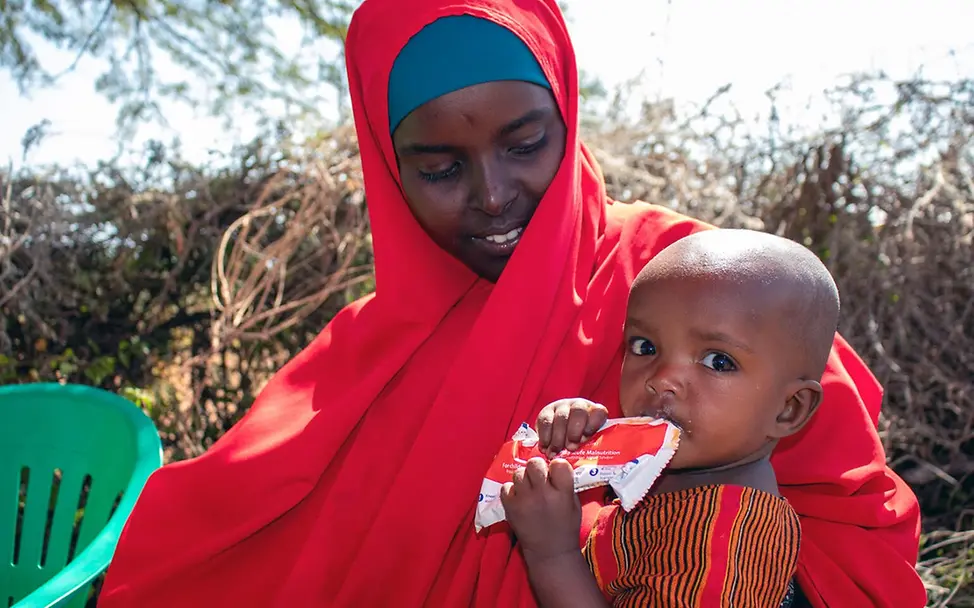 El Niño: Ein mangelernährtes Kleinkind in Somalia bekommt nährende Erdnusspaste. 