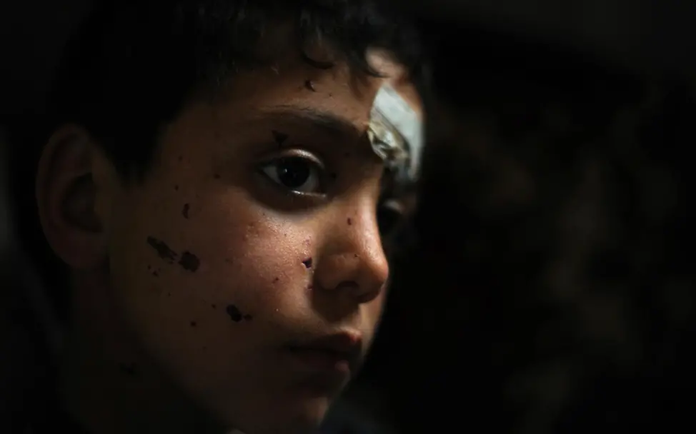 Verletzter syrischer Junge. ©UNICEF/NYHQ2012-0220/Brooks Verletzter syrischer Junge. ©UNICEF/NYHQ2012-0220/Brooks