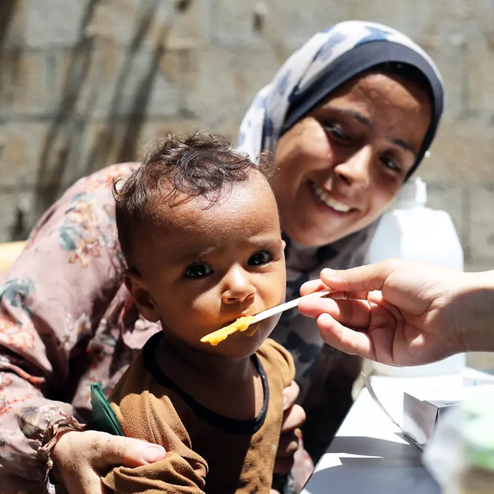 Gaza Waffenruhe: Ein Kind in Gaza bekommt Spezialnahrung gegen den Hunger. 