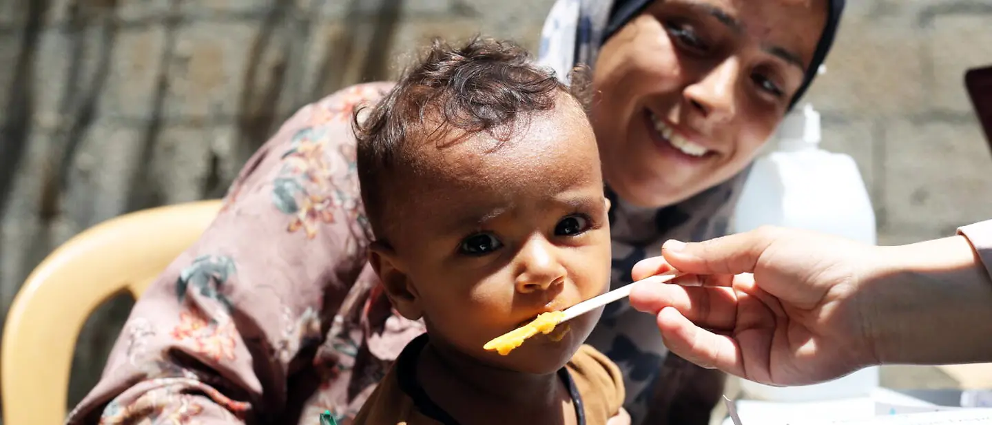 Gaza Waffenruhe: Ein Kind in Gaza bekommt Spezialnahrung gegen den Hunger. 
