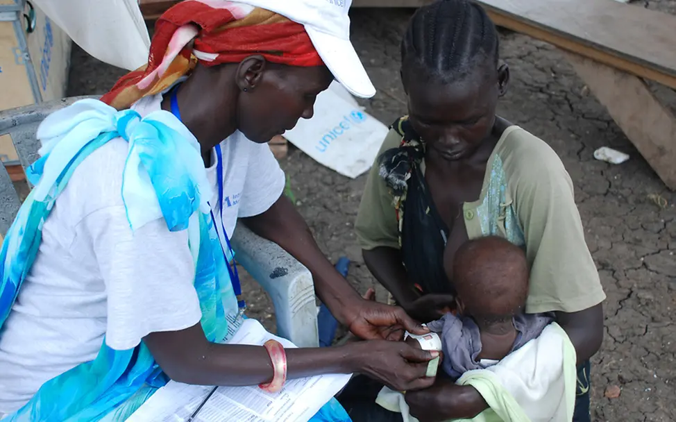 Südsudan: Ein Kind wird auf Mangelernährung untersucht | © UNICEF/Mariantonietta Peru Südsudan: Mangelrnährung bei Kindern