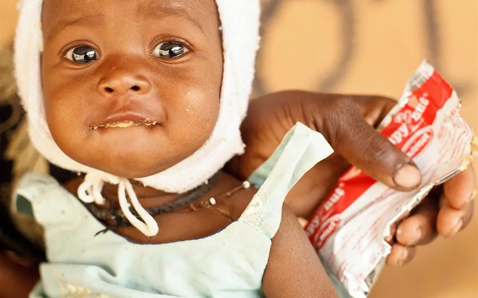Erdnusspaste rettet Leben | © UNICEF/Olivier Asselin Extraportion: Erdnusspaste rettet Leben