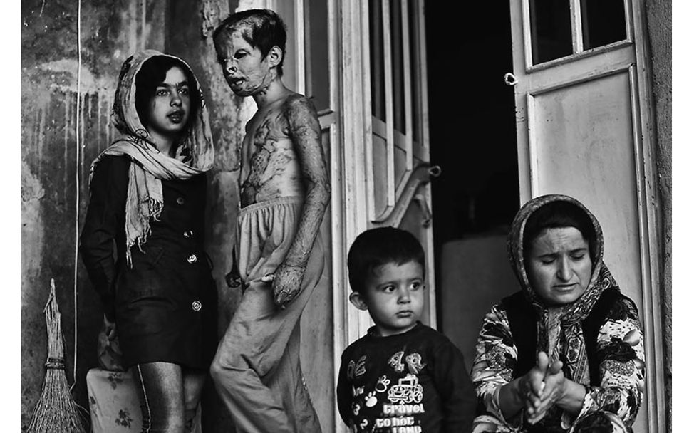 Iran: Den Kindern wieder Gesichter geben! | © Abdollah Heidari/Mehr News Agency Iran: Den Kindern wieder Gesichter geben! | © Abdollah Heidari/Mehr News Agency