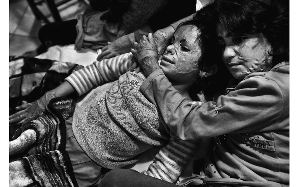 Iran: Den Kindern wieder Gesichter geben! | © Abdollah Heidari/Mehr News Agency Iran: Den Kindern wieder Gesichter geben! | © Abdollah Heidari/Mehr News Agency