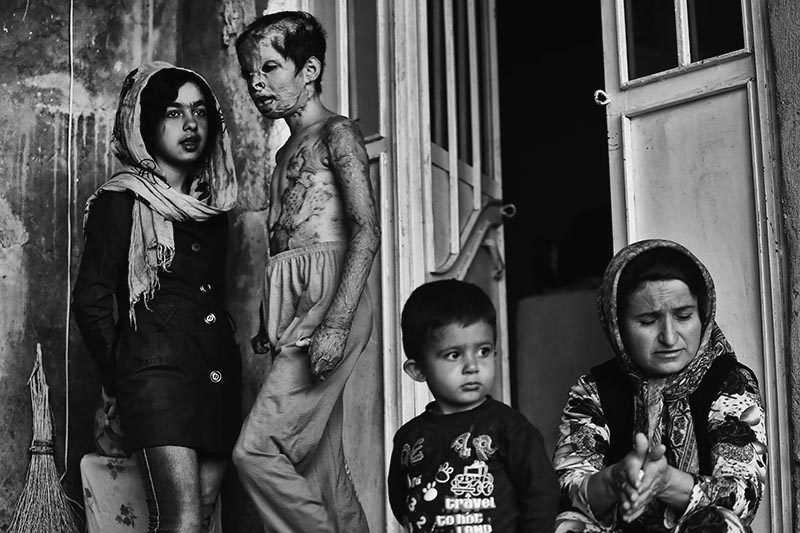 Iran: Giving children their faces back! | © Abdollah Heidari/Mehr News Agency Iran: Giving children their faces back! | © Abdollah Heidari/Mehr News Agency