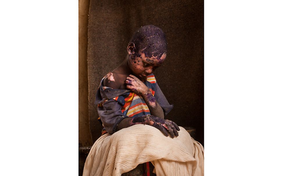 Sudan: The forgotten war | © Adriane Ohanesian (Freelance Photographer)